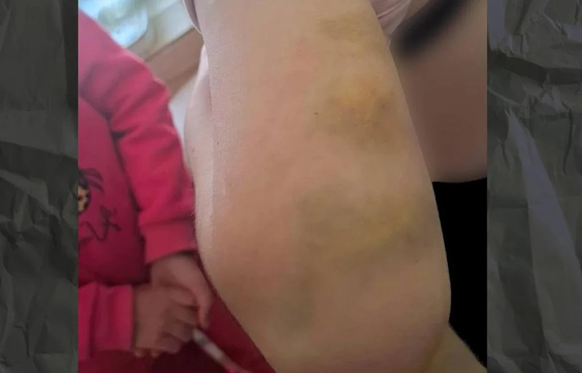 На Полтавщині опікунку підозрюють у катуванні молодших сестер, яких вона змушувала дві доби стояти на колінах без їжі